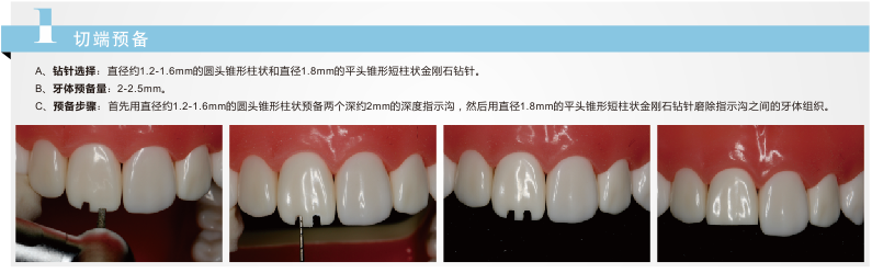 深圳全瓷牙