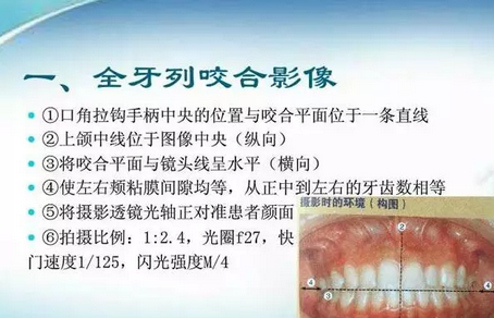 深圳义齿加工