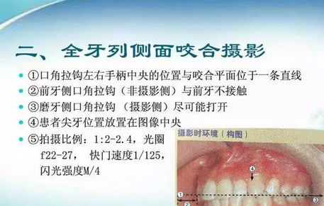 深圳义齿加工