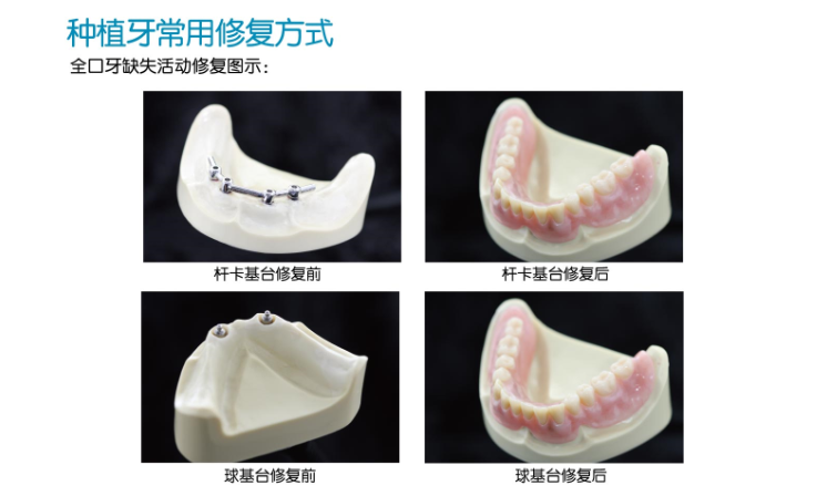 牙齿加工厂