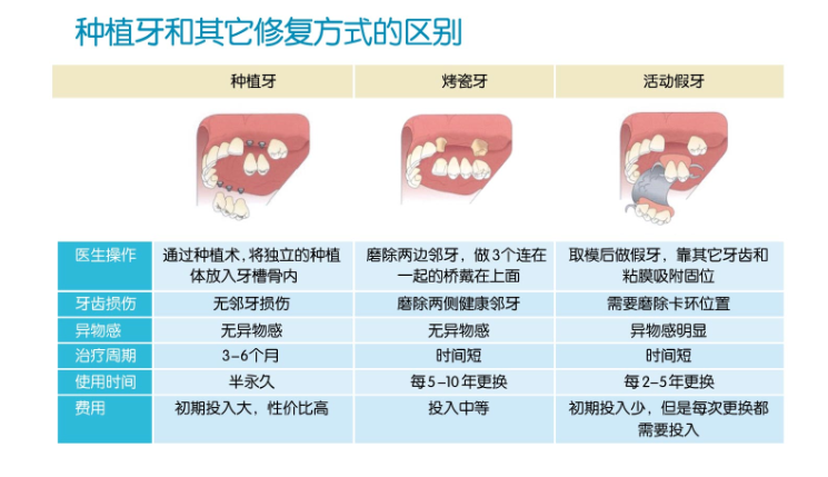  牙齿加工厂