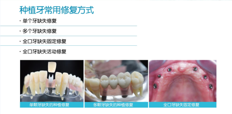  牙齿加工厂